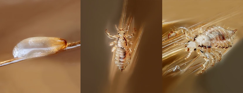 Head-Lice-Life-Cycle